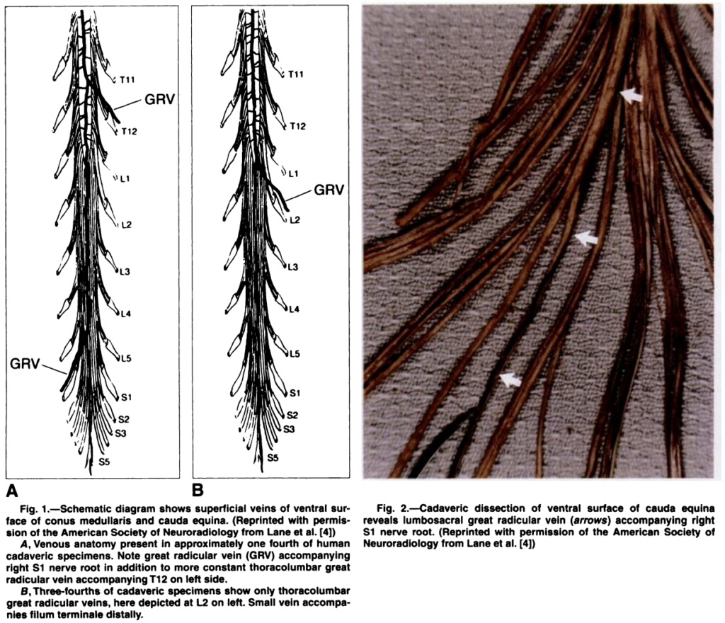 脊髄神経根 spinal nerve root 増強効果 - 医學事始 いがくことはじめ