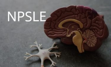 NPSLE: neuropsychiatric SLE