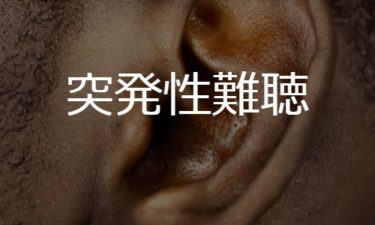 突発性難聴 SSHL: Sudden sensorineural hearing loss