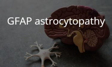 GFAP astrocytopathy