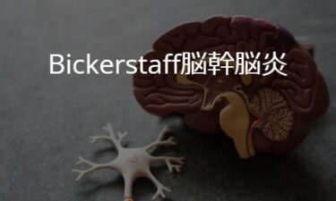 Bickerstaff脳幹脳炎