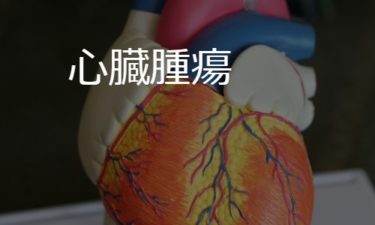 心臓腫瘍 cardiac tumors