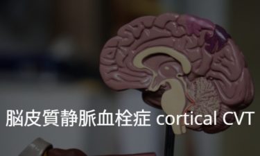脳皮質静脈血栓症 cortical cerebral venous thrombosis
