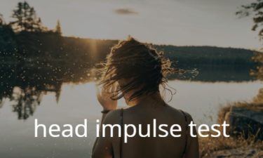 head impulse test