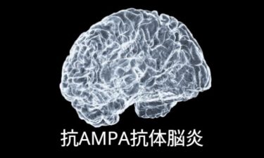 抗AMPA受容体脳炎