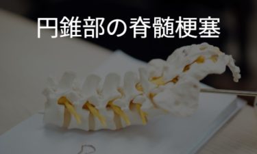 円錐部の脊髄梗塞
