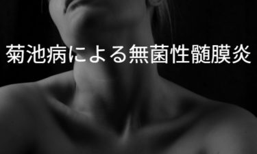 菊池病による無菌性髄膜炎