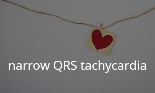 narrow QRS tachycardia
