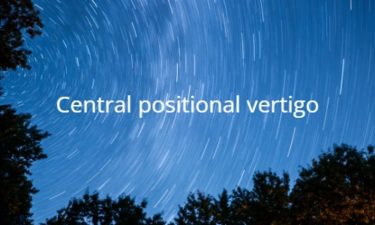 Central positional vertigo CPV